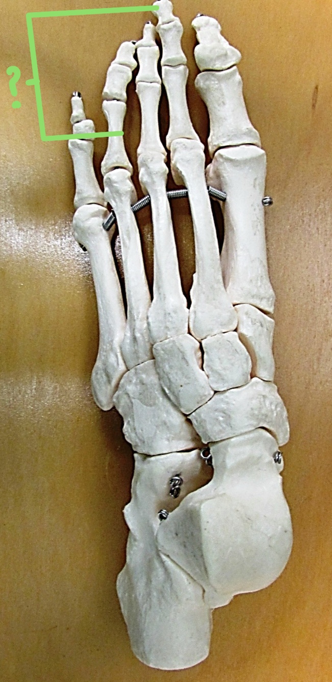 <p>Determine the bone of the foot highlighted &amp; state total # of bones</p>