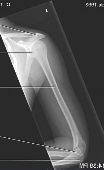 <p>What projection, position, and anatomy is this?</p>