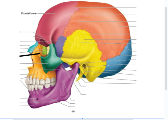 term image