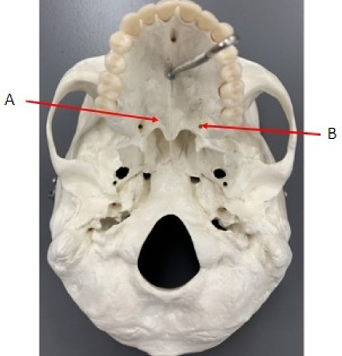 <p>Identify</p>