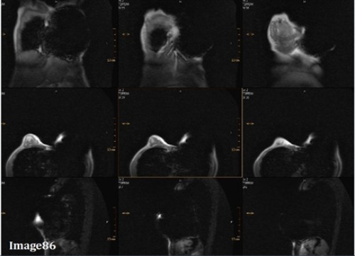 <p><span><strong>Image 86 is an example of which kind of artifact?</strong></span></p>