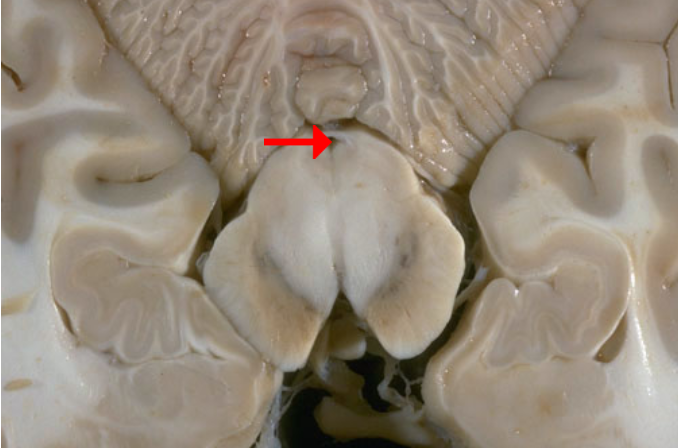 <p>Label this brain structure</p>