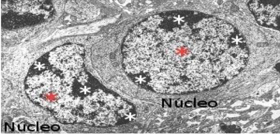<p>2 types of chromatin:</p><p>• Euchromatin: Dispersed chromatin, grey colour:</p><p>active transcription</p><p>• Heterochromatin (90%): Condensed chromatin, darker:</p><p>silenced genes, no transcription</p>