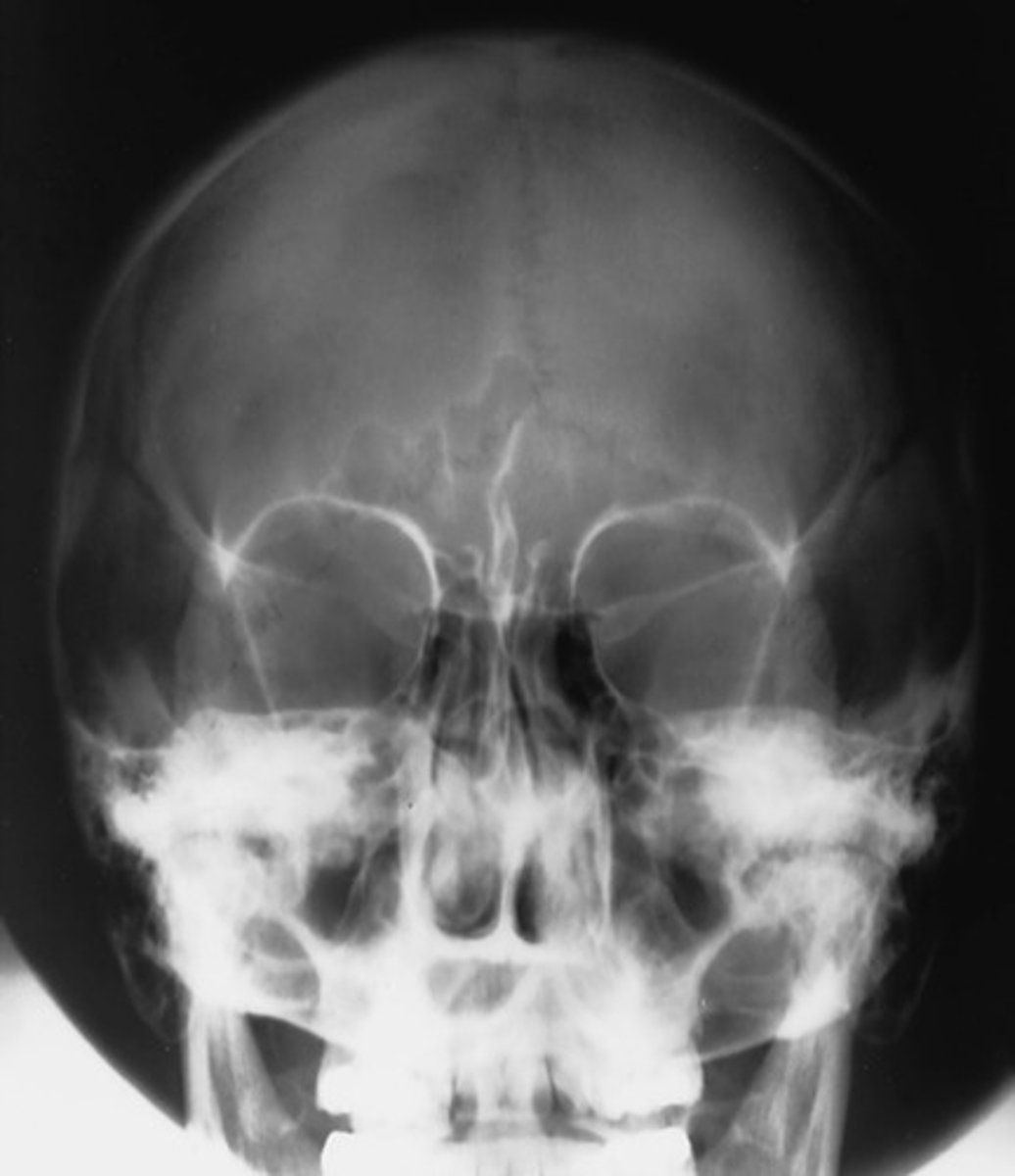 <p>Which position is this?</p>