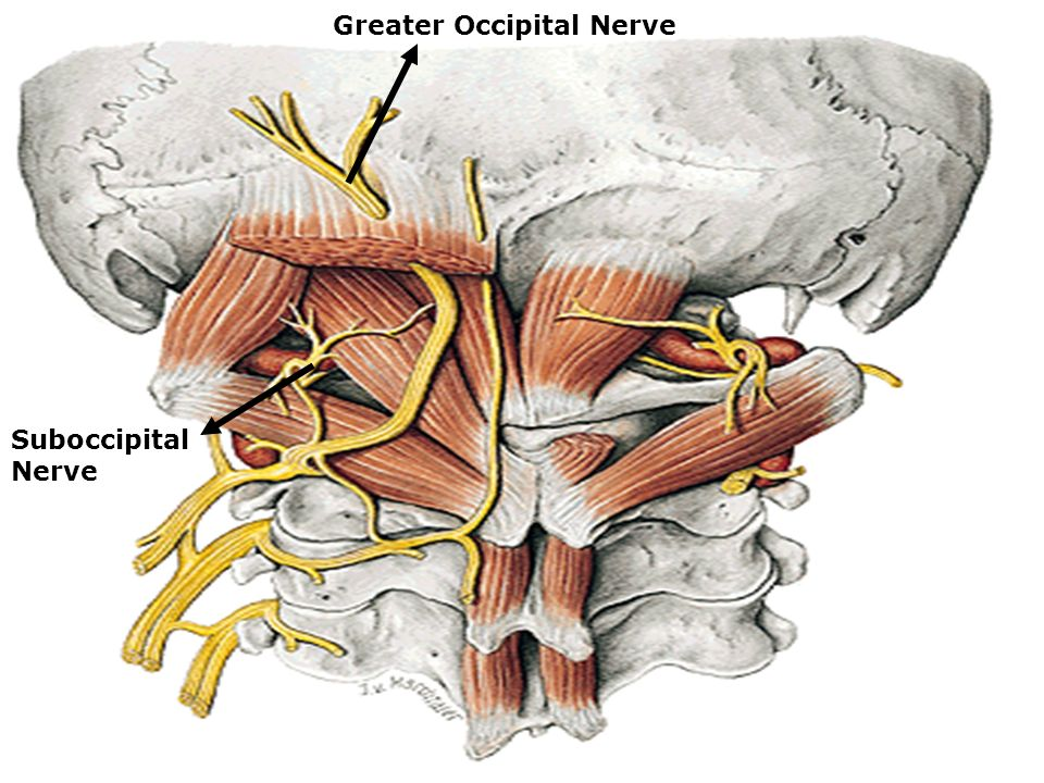 <p>The cutaneous branch of the posterior primary ramus of C2 is called the:</p><p>A. Accessory nerve</p><p>B. Great auricular nerve</p><p><strong><mark data-color="red" style="background-color: red; color: inherit">C. Greater occipital nerve</mark></strong></p><ul><li><p>emerges between the first and second cervical vertebrae</p></li><li><p>travels superiorly to provide <strong>sensory innervation</strong> to the <strong>posterior scalp and upper neck</strong></p><ul><li><p>sensory innervation of the back of the head</p></li></ul></li><li><p>The <strong>greater occipital nerve</strong> is the <strong>cutaneous branch of the posterior primary ramus of C2</strong>.</p></li><li><p>It supplies sensation to the <strong>back of the scalp up to the vertex</strong>.</p></li><li><p>It can be involved in conditions like <strong>occipital neuralgia</strong>, causing headaches at the back of the head</p></li></ul><p>The <strong><u>greater occipital nerve</u></strong> is the <strong><u>skin (cutaneous) nerve</u></strong> that comes from the <strong><u>back branch (posterior ramus)</u></strong><u> </u>of the <strong><u>C2 spinal nerve</u></strong>, and it supplies <u>sensation to the </u><strong><u>back of the scalp</u></strong></p><p>D. Lesser occipital nerve</p><p>E. Superior ramus of the ansa cervicalis</p>