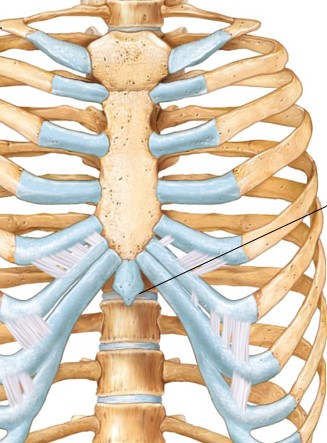 <p>What kind of vertebrae is the arrow pointing to?</p>