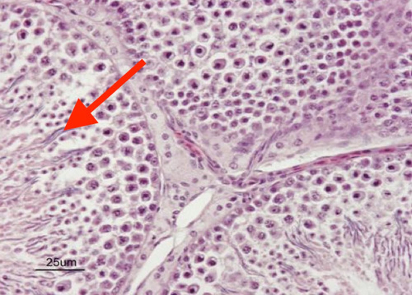 <p>what are these linear structures in the testes?</p>