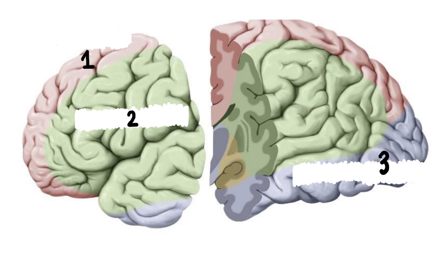 <p>Which artery distributes blood to each of these brain regions?</p>