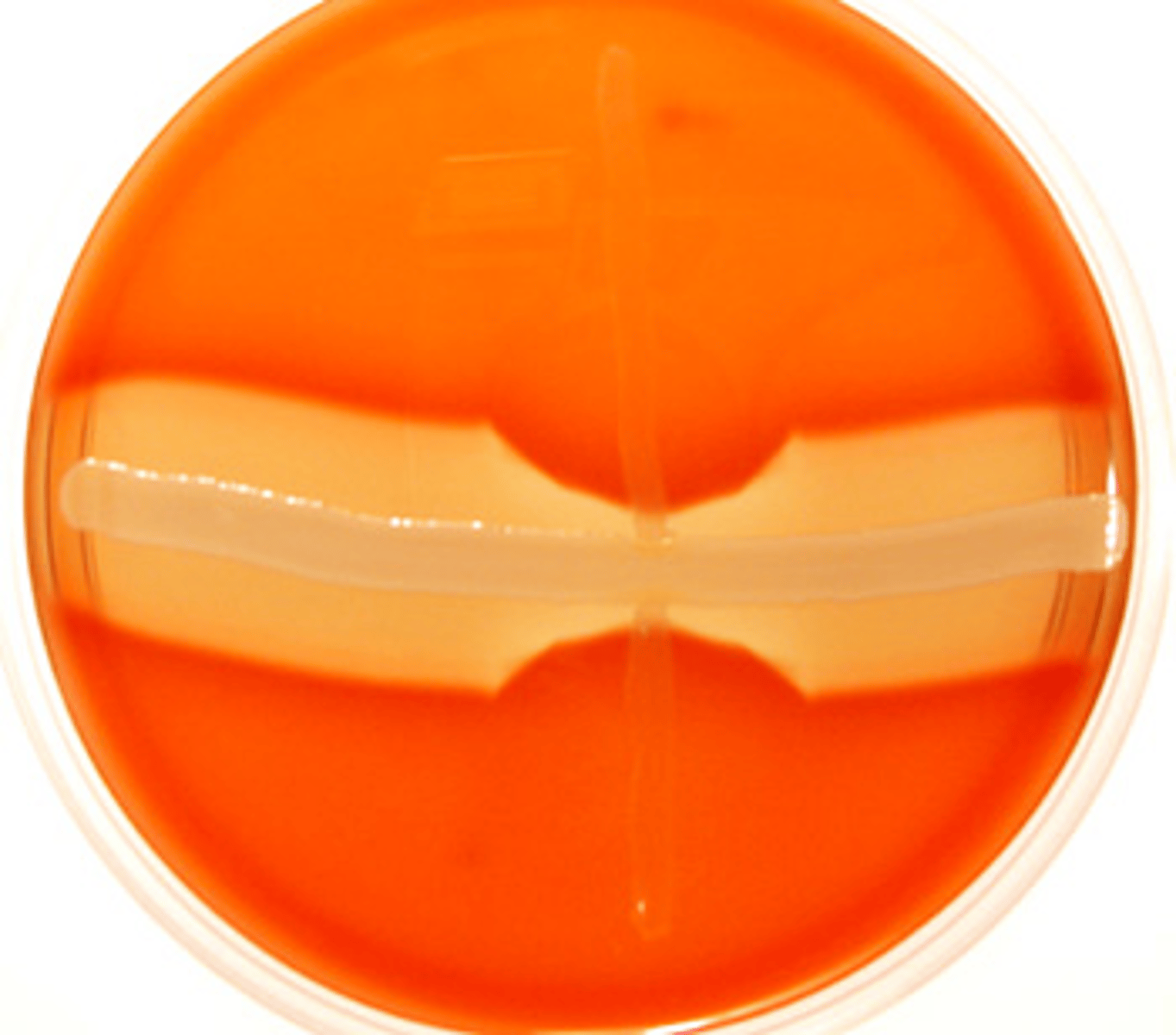 <p>Illustrated growing on the surface of the blood agar plate shown in the upper left image are small distinctly beta hemolytic colonies suggestive of beta hemolytic streptococci, particularly when specimens are obtained from patients with an upper respiratory infection. Gram-positive bacilli in branching and Chinese letter formations are observed on Gram stain as illustrated in the upper right image. Observe the reverse CAMP reaction in the lower image. From these observations, select the identification of this bacterial isolate.</p>