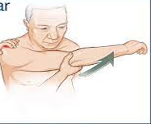 <ul><li><p>special test for AC joint </p></li><li><p>elevate arm to 90° flexion then maximum horizontal adduction</p></li><li><p>positive = pain on top of shoulder near AC joint</p></li></ul><p></p>