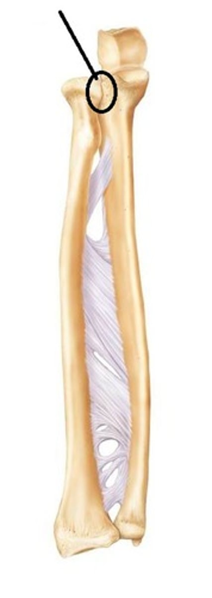 <p>Articulates with the head of the ulna</p>