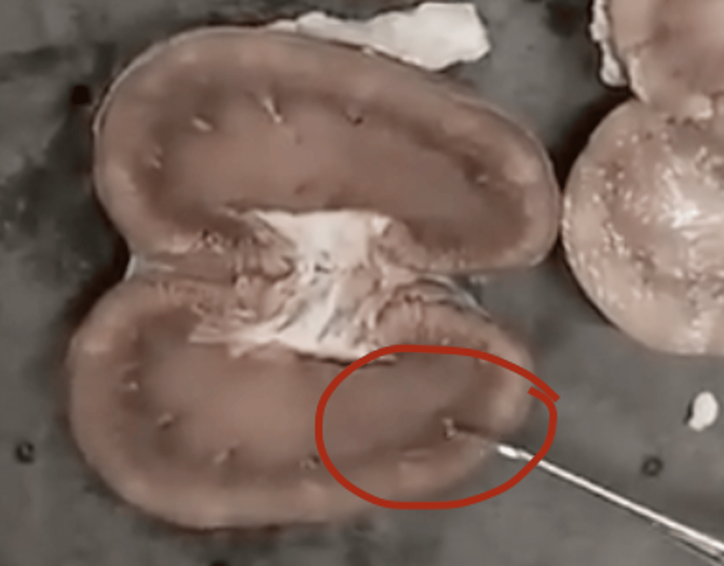 <p>Microscopic unit of kidney responsible for urine production.</p>
