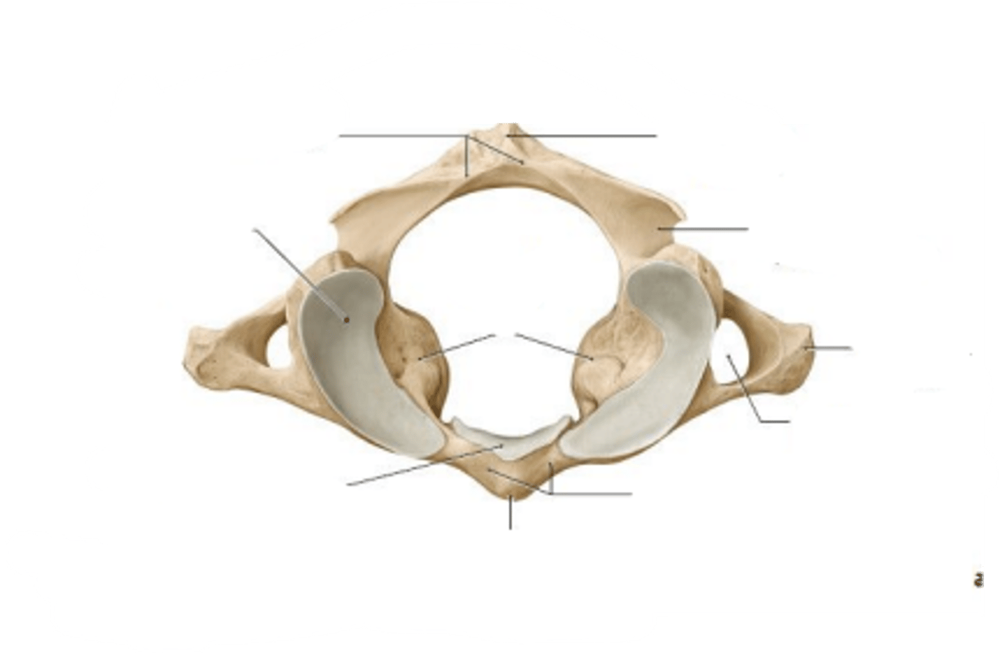 <p>What is the name of the displayed cervical vertebrae?</p>