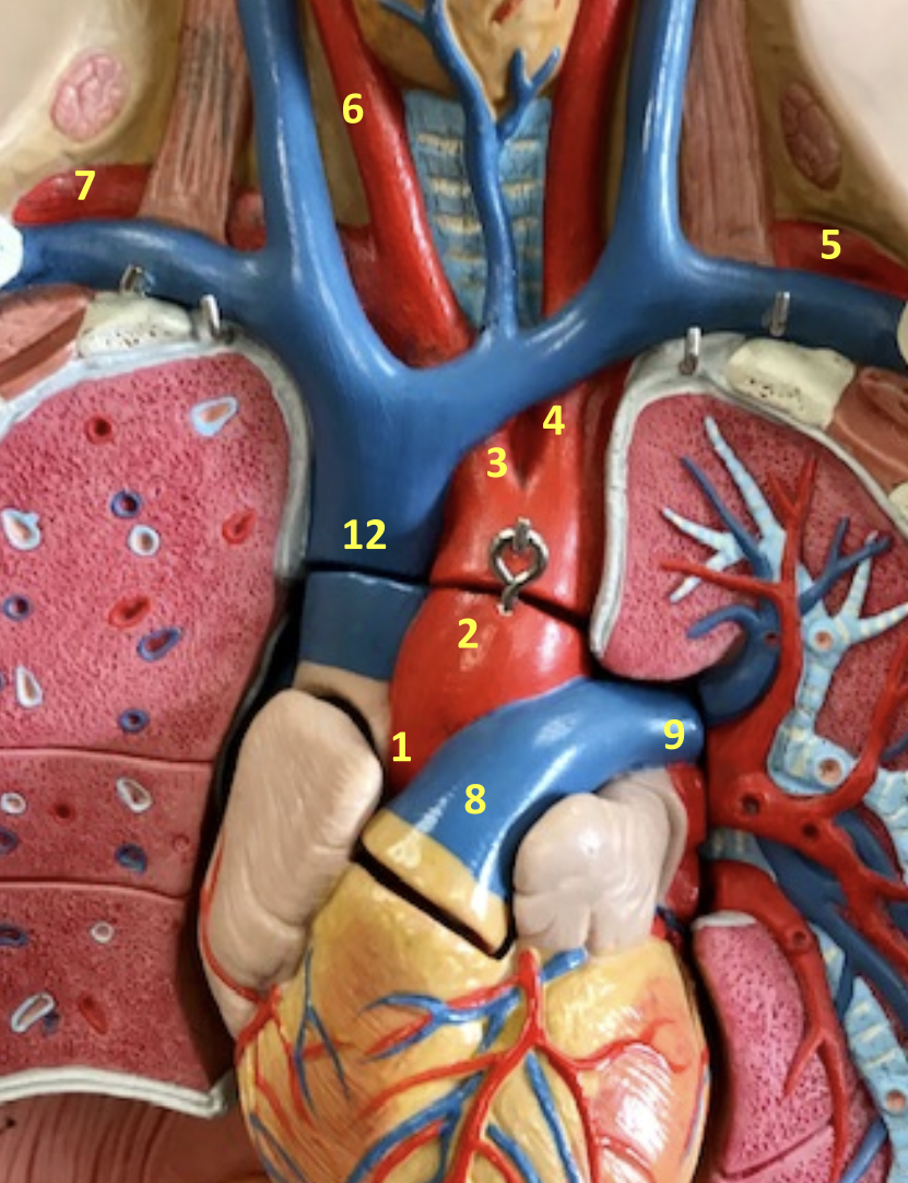 <p>Identify blood vessel 3</p>