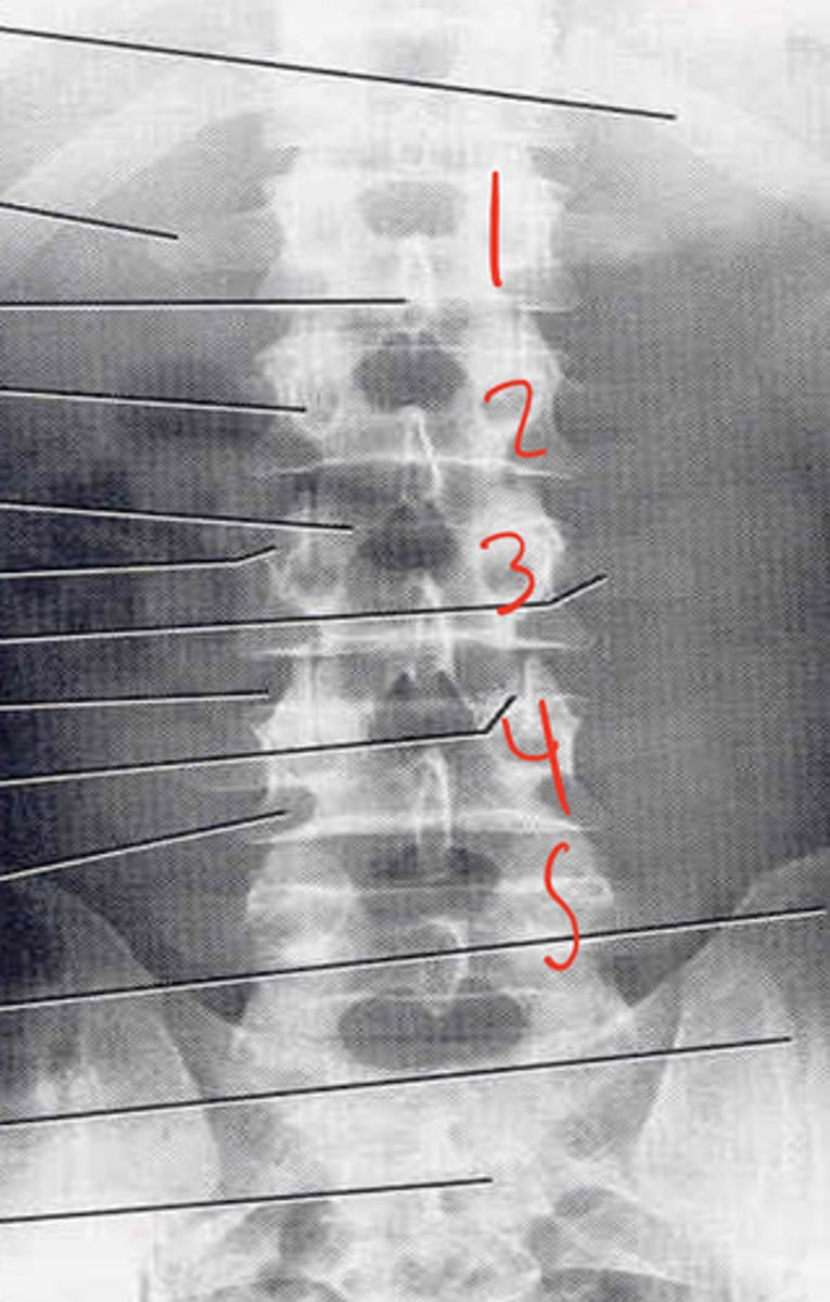 <p>what is this image?</p>