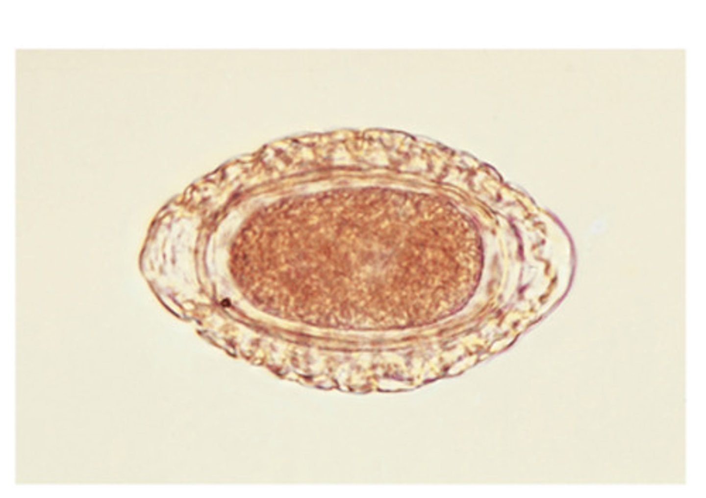 <p>This nematode ovum can be found in urine sediment of dogs. The parasite is __________________.</p>