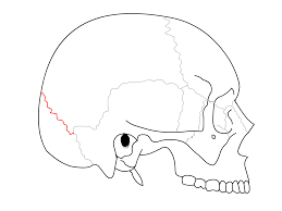 <p>Between occipital and parietal bones</p>