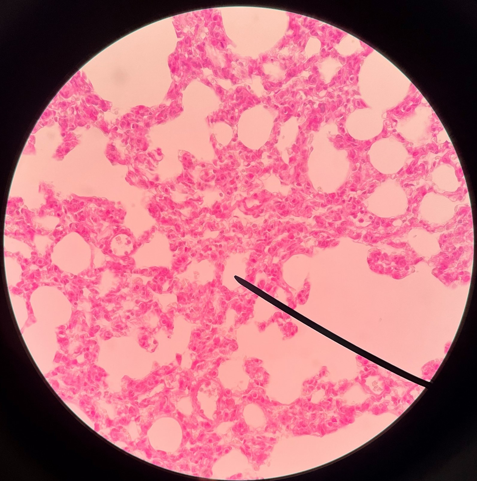 • Where respiration occurs in the lungs.

• Budded on alveolar sacs.
