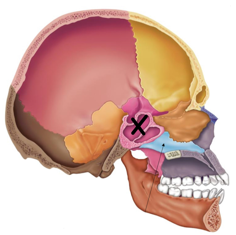 term image