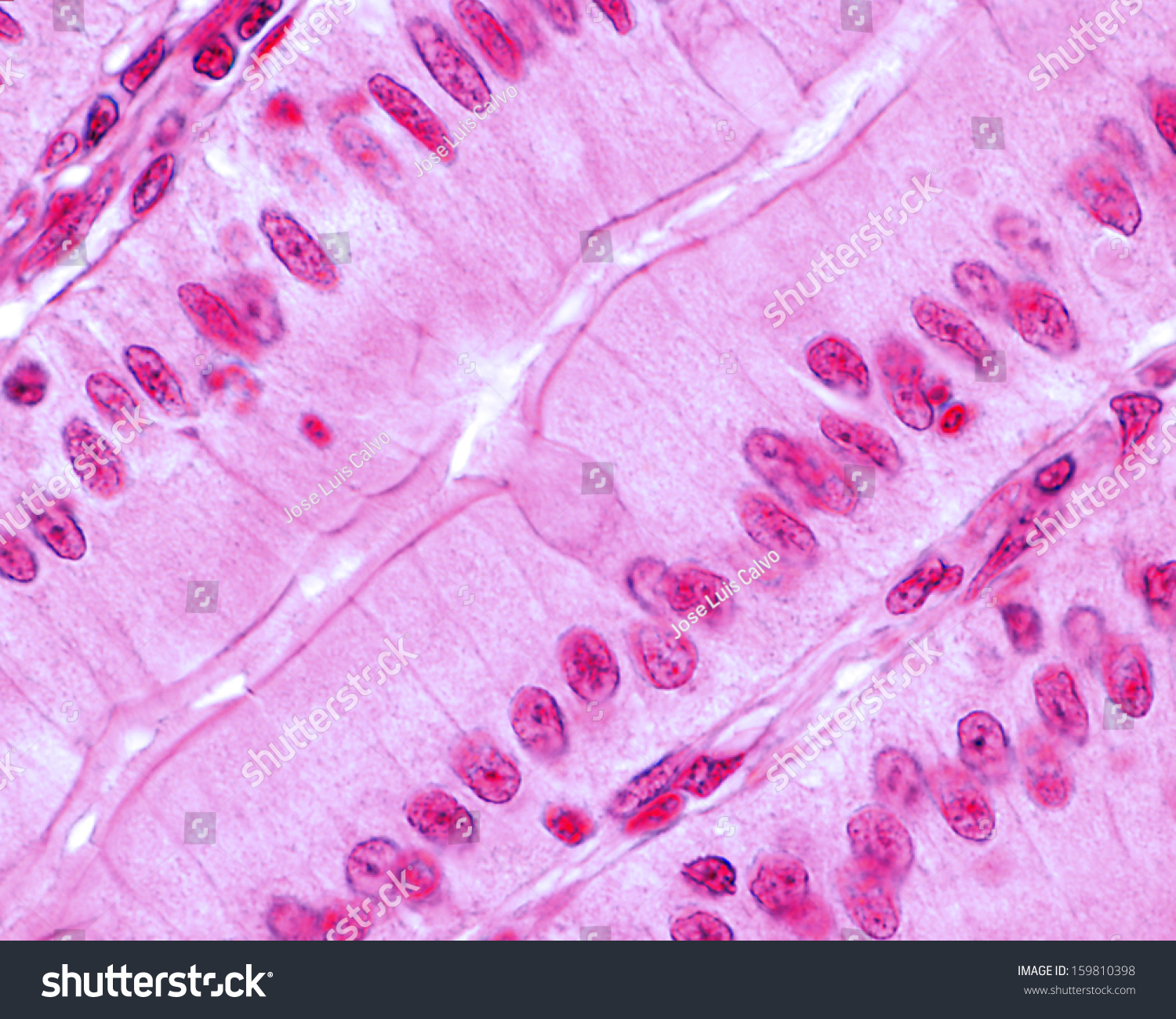 <p>The free surface of an epithelial cell exposed to the body exterior or cavity interior.</p>