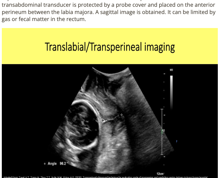 <p>d) translabial approach, empty bladder, sag image</p>