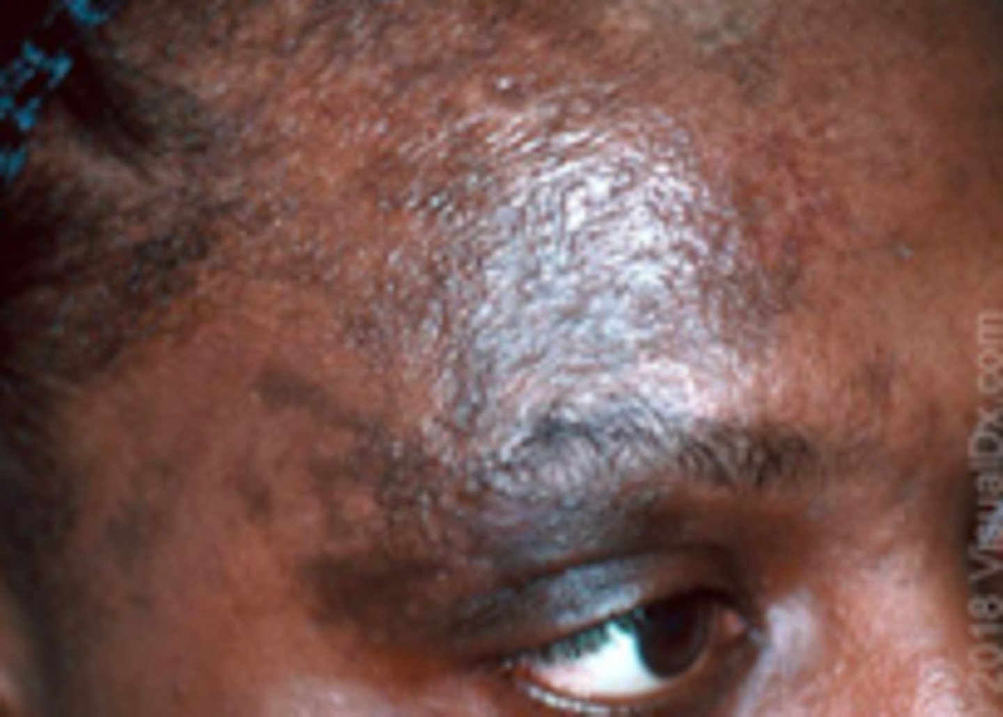 <p>Viral ID:</p>
