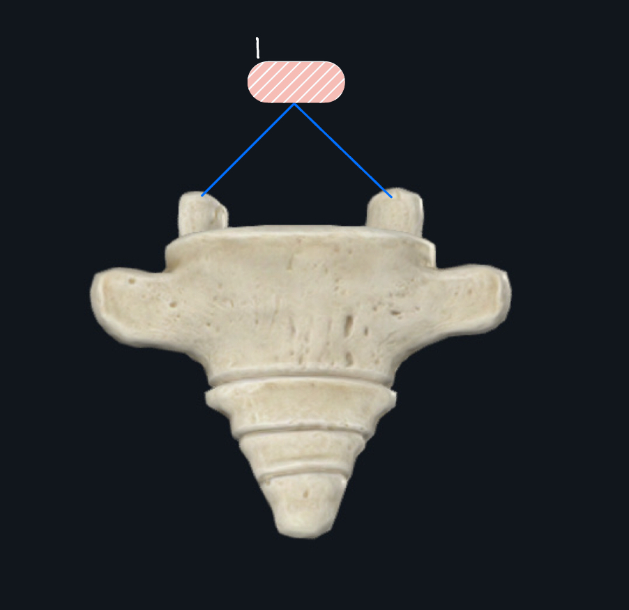 <p>What bone is this?</p>