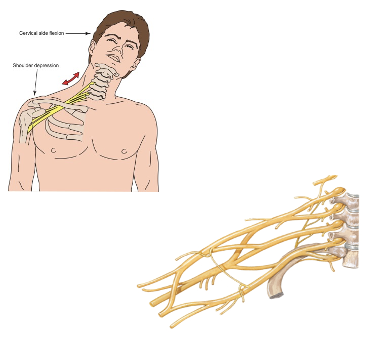 <p>Symptoms follow innervation from the brachial plexus</p>