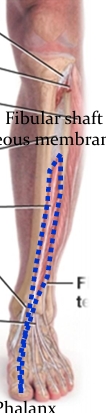 <p>Name this muscle </p>