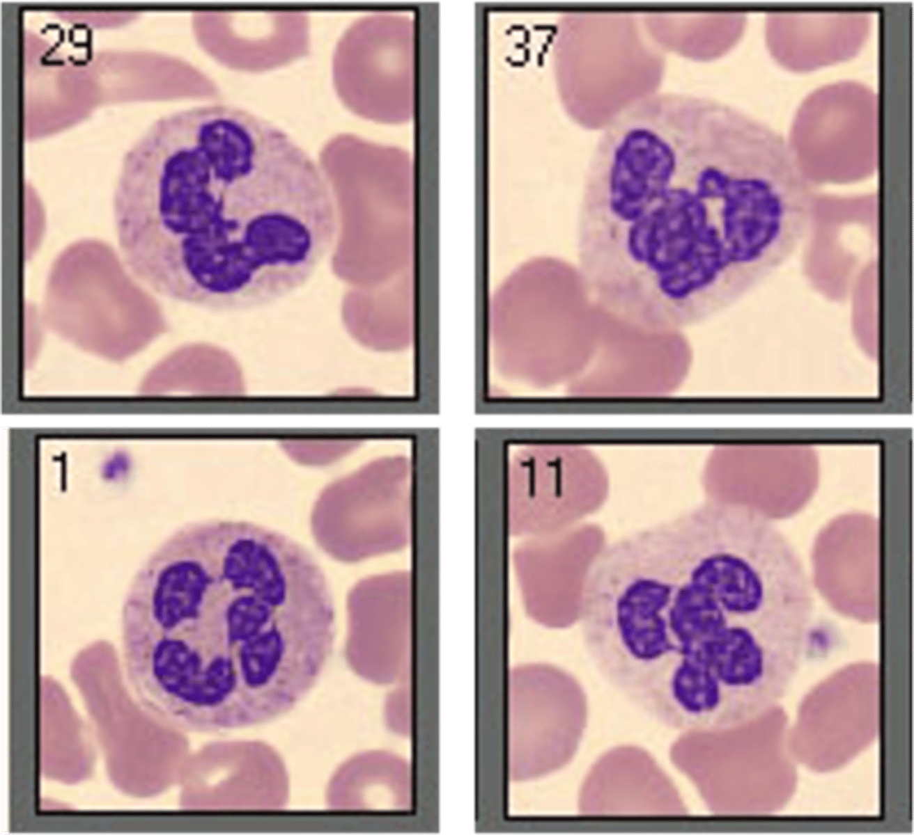 <p>9-15 μm in size, with a nucleus that is segmented into three to five lobes connected by a thin nuclear filament. Most have three or four lobes.</p>