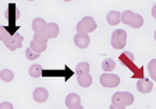 <p>Found in cats</p>