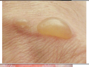 <span style="color: rgb(8, 4, 4);"><span>What kind of skin conditions is this?</span></span>