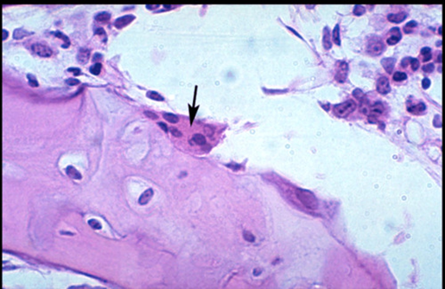 <p>large multinucleate cells that are formed by fusion of monocytes (large WBC); reside on bone surfaces and secrete acid and digestive enzymes that break down and return calcium to blood</p>