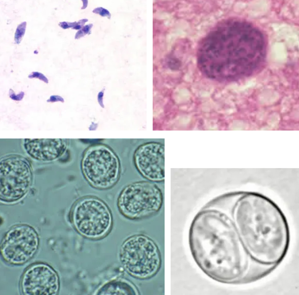 <p>Rare in fecal flotation</p>