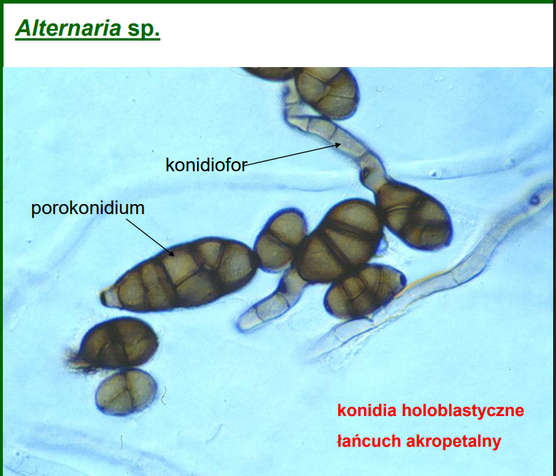 <p>-należy do Ascomycota (anamorficznych)</p><p><em>Alternaria</em> sp.<br>-rozkłada szczątki roślinne<br>-porokonidium specyficzne dla tego gatunku!</p>