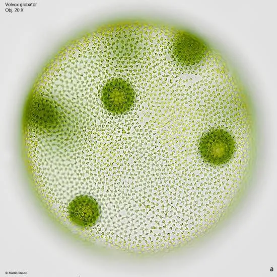 <p>What protist/fungus is this?</p>