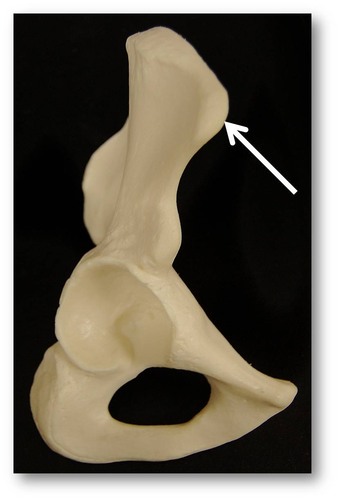 Name this specific part of the pelvic bone.
