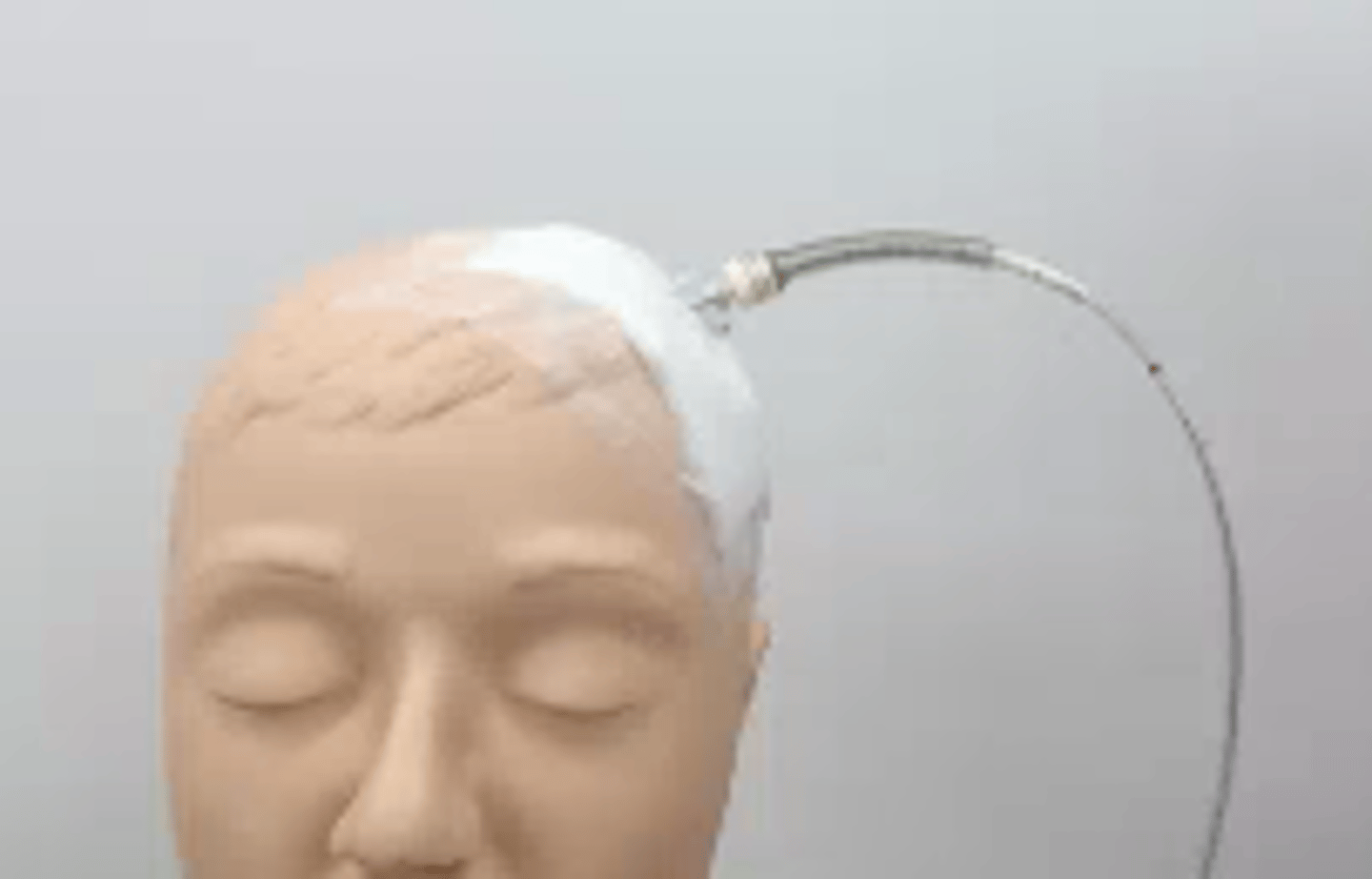 <p>measures pressure in pt.'s head (pressure against skull and brain tissue)</p><p>- normal intercranial pressure: 4-15 mm mercury</p><p>- avoid prone position, isometric exercise, head flexion, hip flexion more than 90 degrees and valsalva maneuver</p><p>- head of bed should be 15 degrees elevated</p>