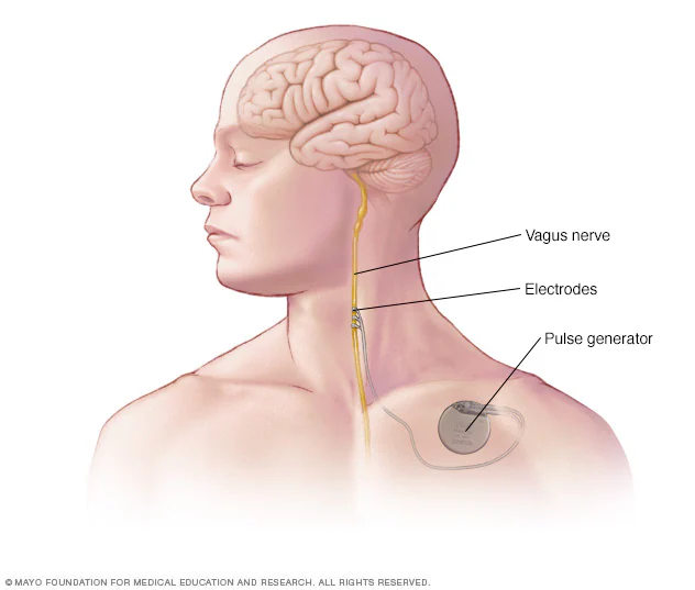 <p>Know the cranial nerve</p>