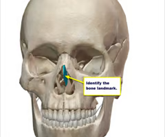 <p>part of nasal septum</p>
