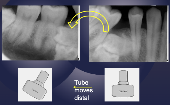 <p>apply the SLOB rule (tube shift technique) to determine if the impacted tooth is lingual or buccal</p>