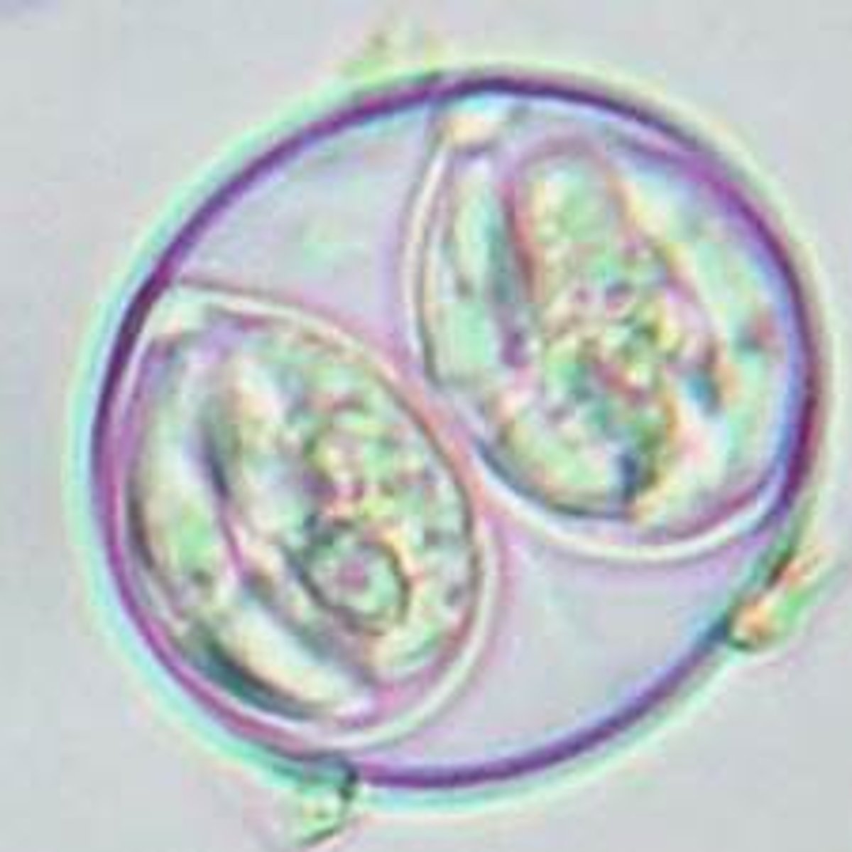 <p>Structures that look like this (measuring between 25 to 40um in diameter) may be found on the fecal flotation of dogs and cats. What is it?</p>