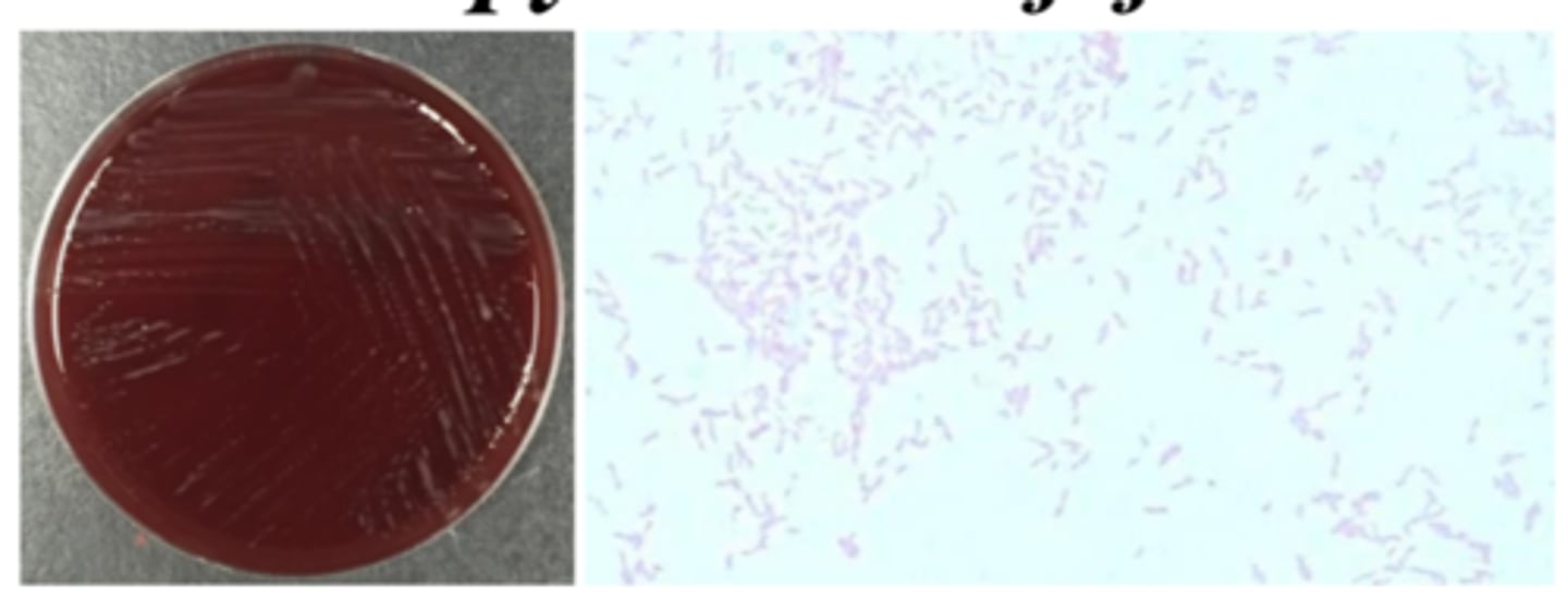 <p>-Oxidase-positive</p><p>-Microaerophilic (5% O2)</p><p>-Hippurate-positive</p><p>-42°C (warmer than body temp)</p><p>-Selective medium</p><p>-found in poorly stored food</p><p>-gull-winged bacilli</p><p>-watery colonies</p><p>-Co #1 bacterial GI pathogen</p>