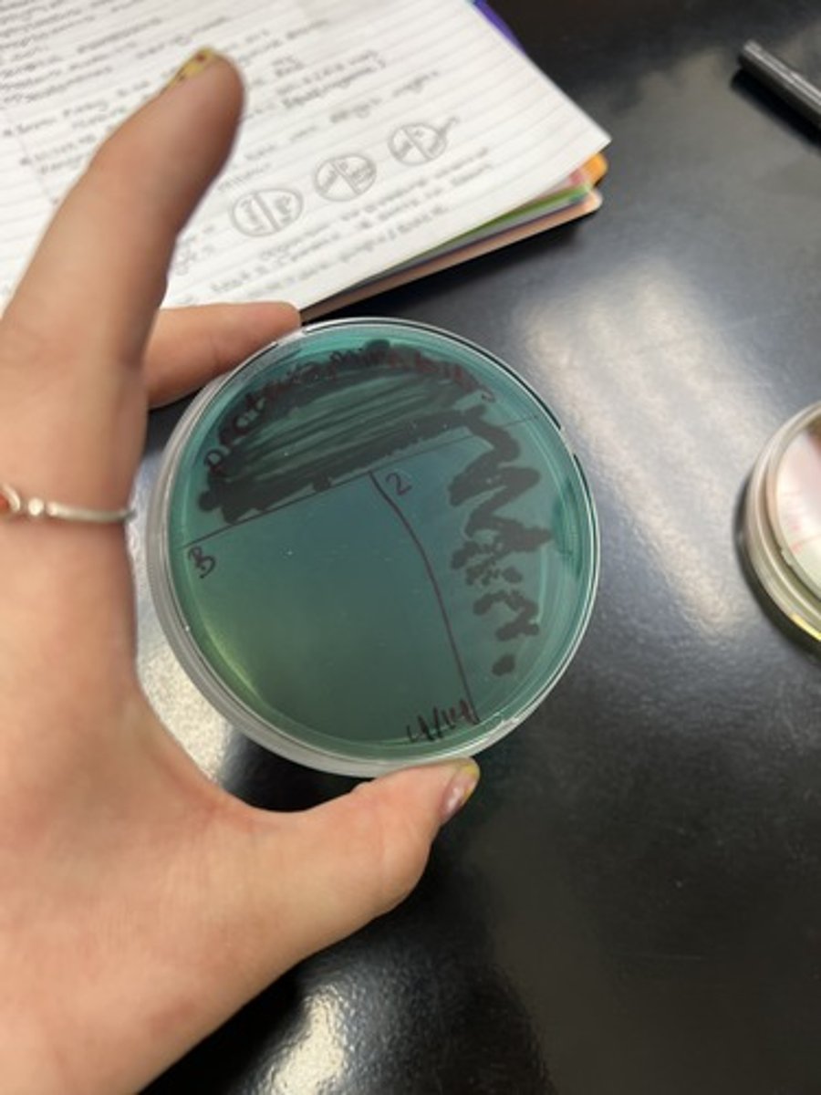 <p><strong>Selective </strong>for Gram (-) sp.</p><p><strong>Differential </strong>for Lactose, Sucrose, &amp; Salicin</p><p>Neutral: Blue/ Green</p>