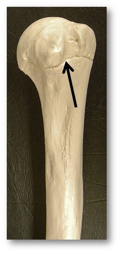 Name this specific part of the humerus.