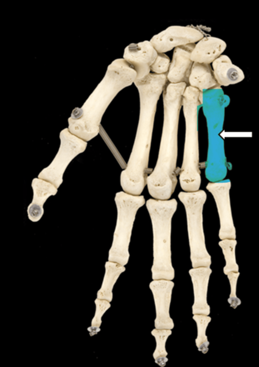 <p>name the part</p>