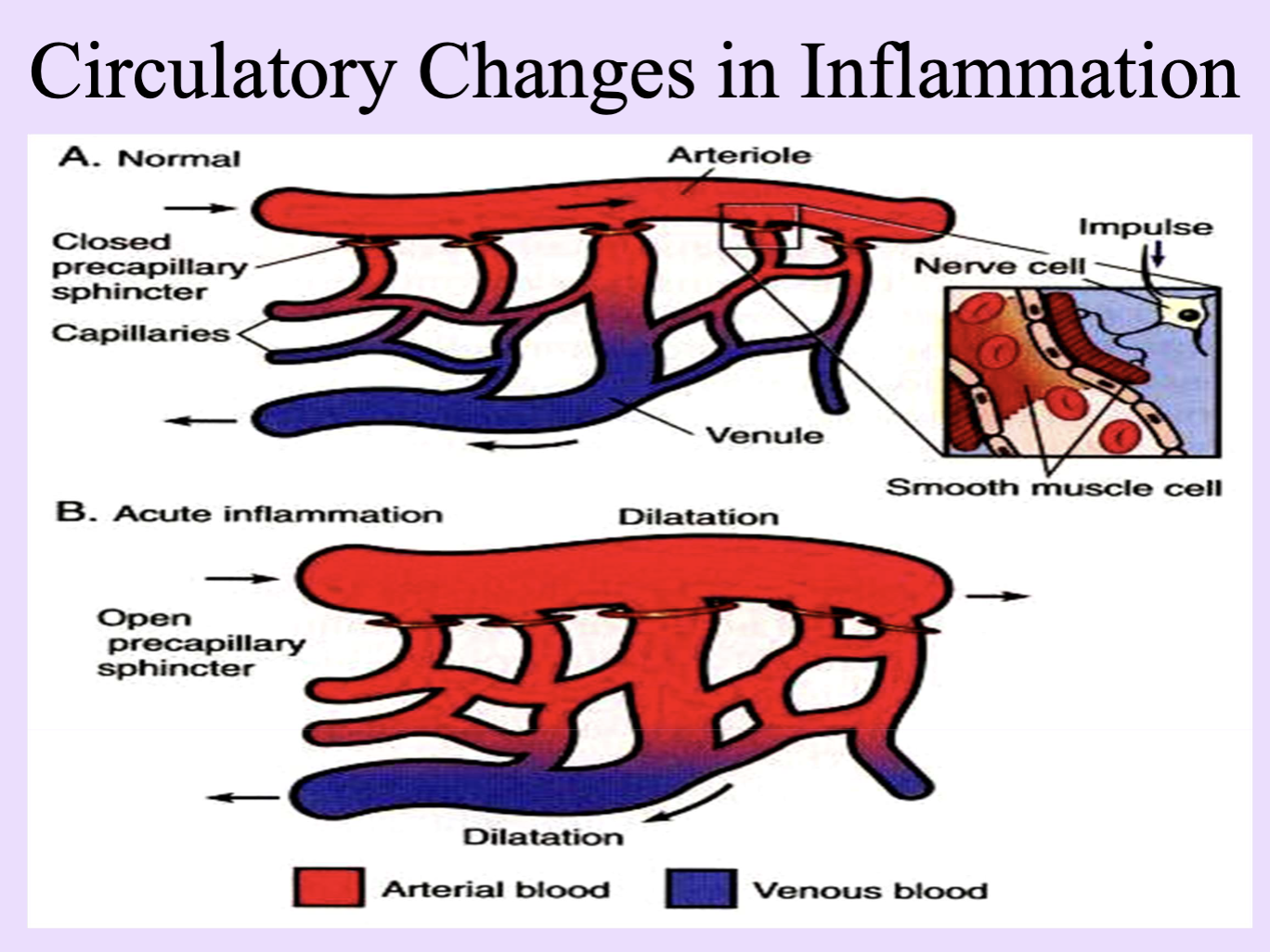 <ol><li><p>Change in blood flow</p></li><li><p>Mech. stimulus stimulates the nerves to signal smooth muscle cells of pre-capillary arterioles = regulate inflow of blood into capillaries</p><ul><li><p>Relaxation of smooth muscles = blood in capillaries → redness, swelling, warmth</p></li></ul></li></ol><p>First response of arterioles to injury = vasoconstriction (seconds) then vasodilation and relaxation</p><p></p><p></p>