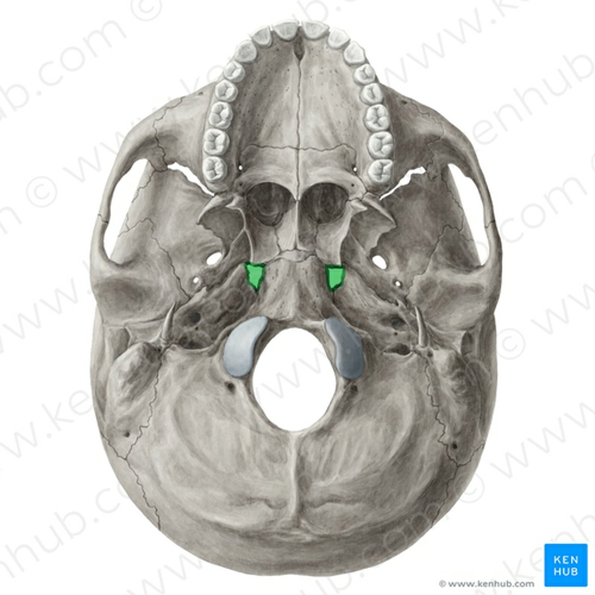 <p>exist only in the diseased, dry cranium, between occipital, temporal, sphenoid bone</p>