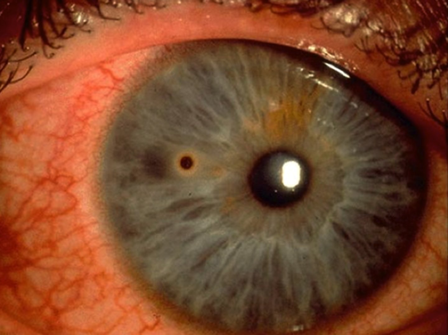 <p>: Dị vật</p><p>Synonyms: External object, alien object</p><p>Example: A small foreign body was lodged in his eye</p>