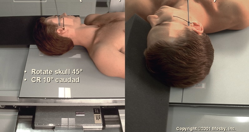 <p>What position is this?</p>